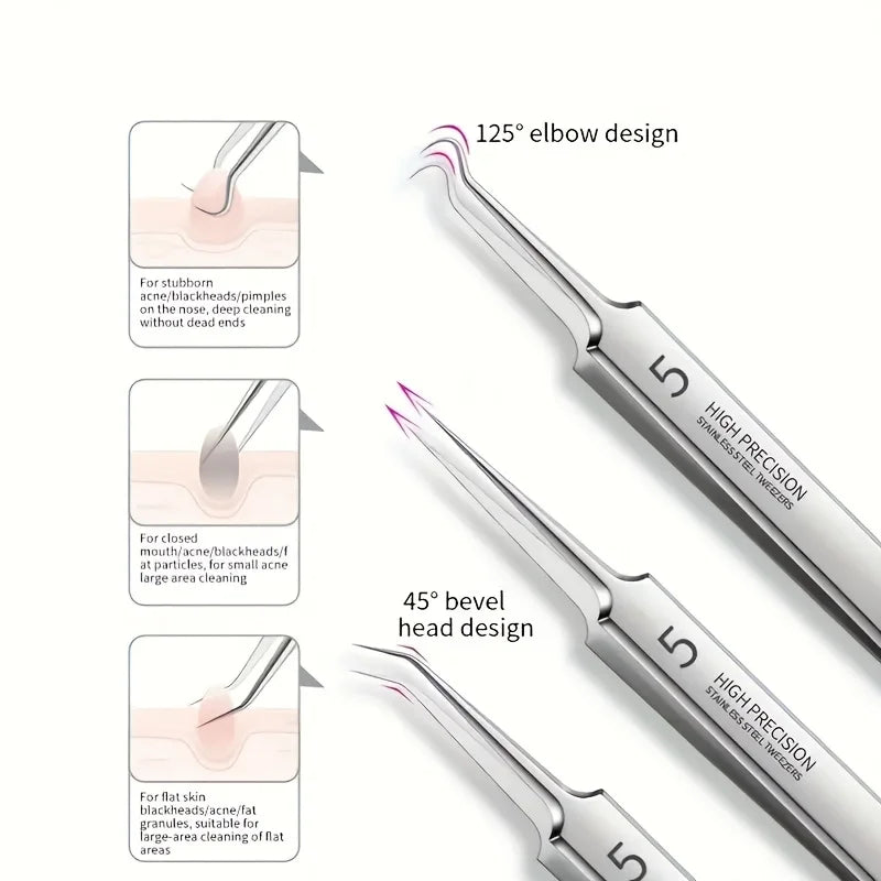 Pro Blackhead Remover Extraction Kit